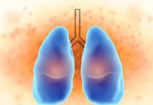 白肺症状_肺部白肺是什么感染_白肺临床表现