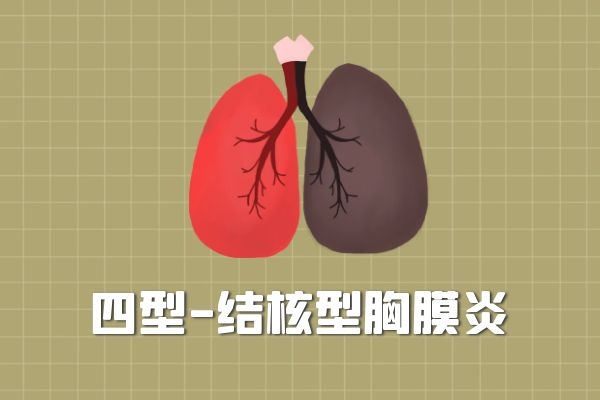 继发性肺结核能活多久-继发性肺结核到底有多可怕？了解这些你就知道了