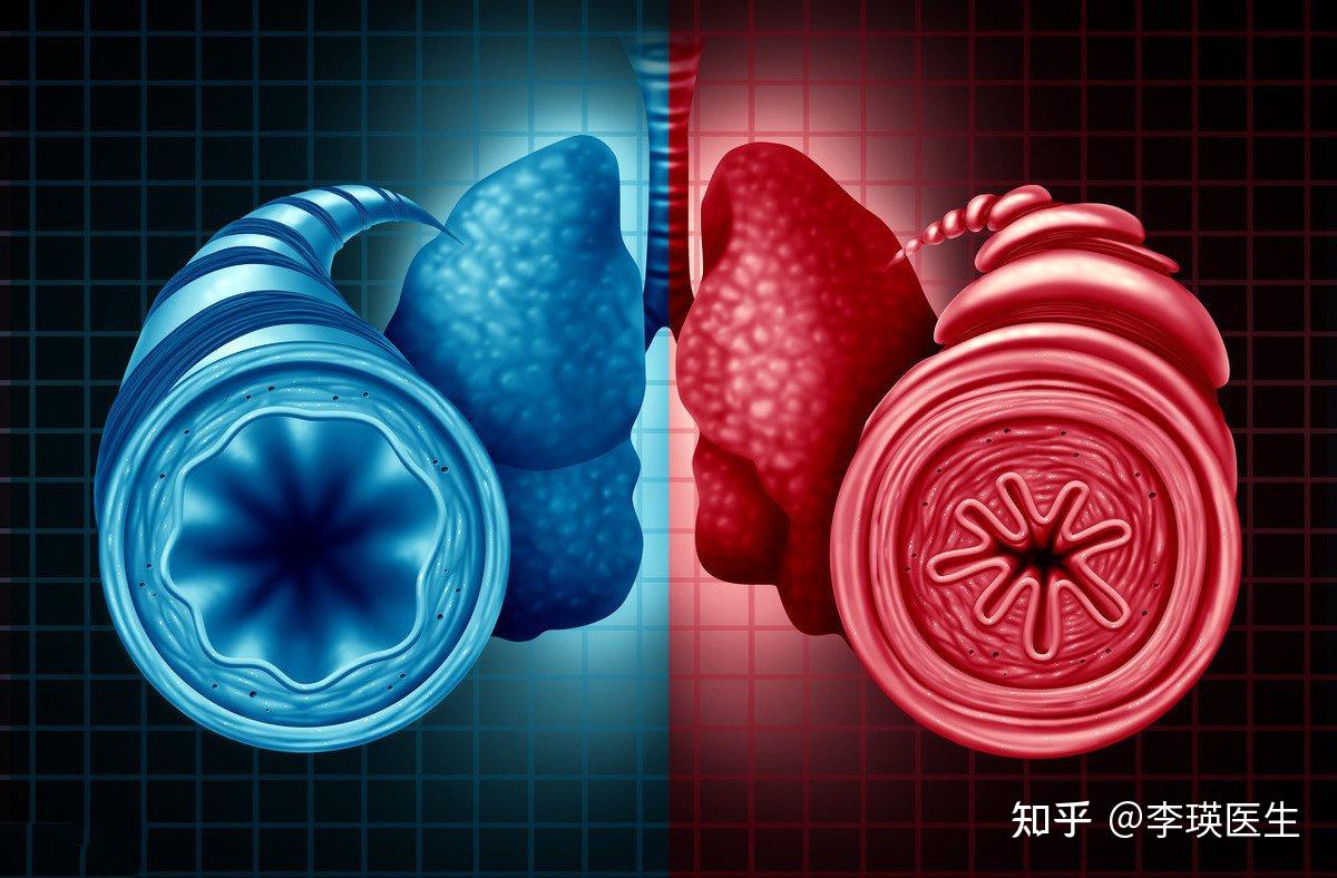 哮喘犯了视频_视频哮喘犯病是真的吗_哮喘犯病视频