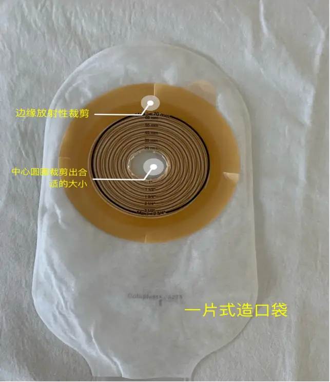 肛门失禁有救吗_肛门失禁的定义_肛门失禁最常见的并发症