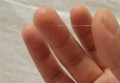 宝宝肺炎的症状_症状肺炎宝宝怎么护理_症状肺炎宝宝吃什么药