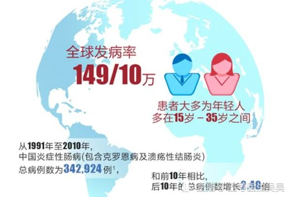 克罗恩病的药物治疗_罗克罗恩病_药物病治疗罗恩克菌的原理
